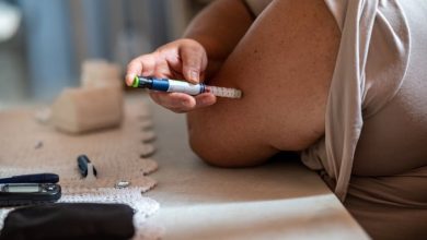 2 Underrated Weight Loss Stocks to Buy Now