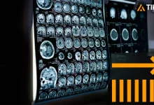 Jazz Pharmaceuticals Stock at 5: Here’s Why Analysts See a New All-Time High in 2026