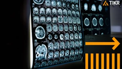 Jazz Pharmaceuticals Stock at 5: Here’s Why Analysts See a New All-Time High in 2026